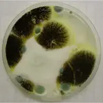 Black Mold Removal-toxic black mold in petri dish -toxic black mold removal