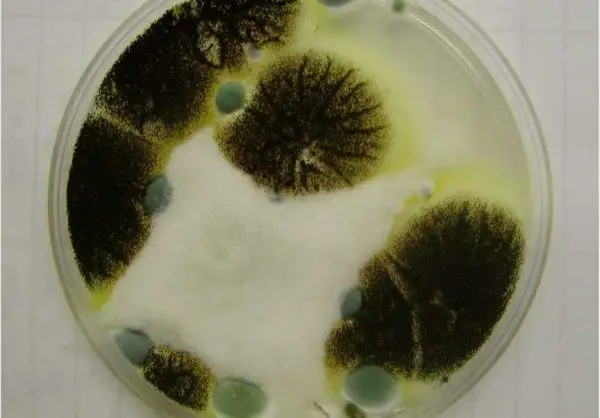 toxic black mold in petri dish -toxic black mold removal